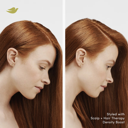 Dove Scalp + Hair Therapy Density Boost Clarifying Shampoo, 9.25 Oz